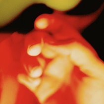 Локсток - Идеальная